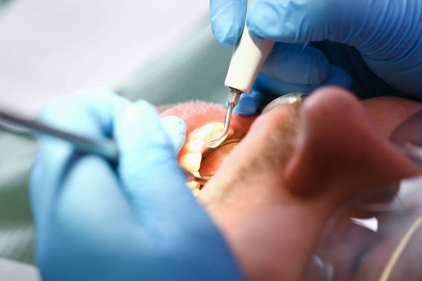 Best Emergency Root Canal Treatment in Tutwiler, MS